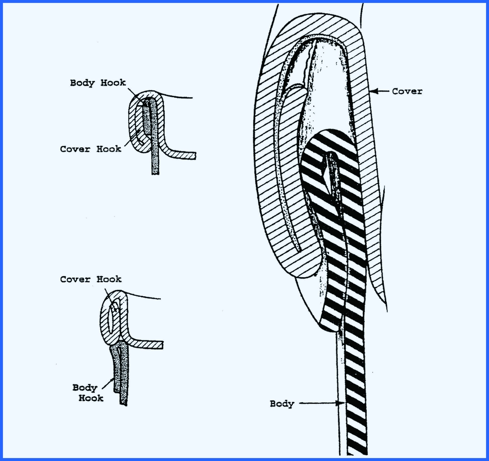 Querschnittsdiagramm einer ordnungsgemäß geformten Doppelnaht, das das Ineinandergreifen von Körper- und Deckelhaken bei der Vernähung einer Metalldose zeigt.